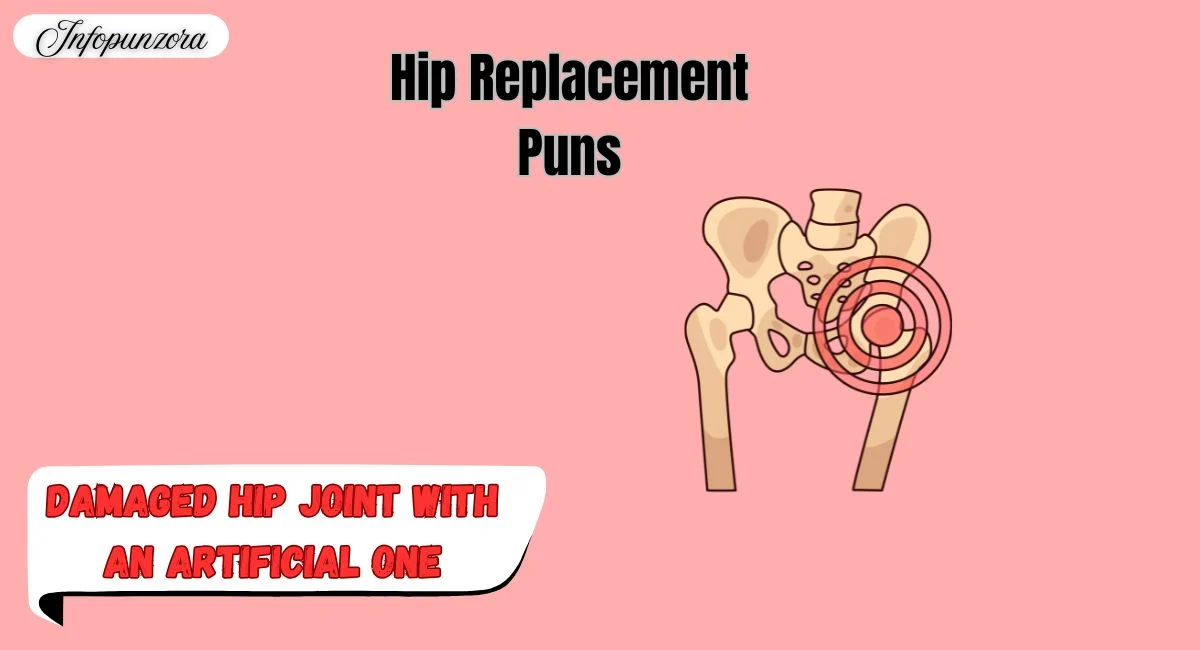 Hip Replacement Puns